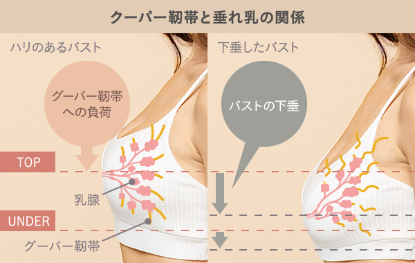 クーパー靭帯と垂れ乳の関係