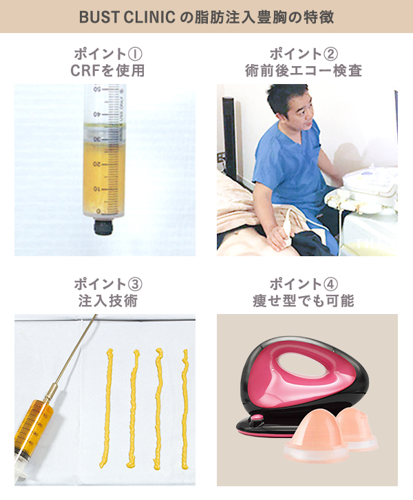 BUST CLINICの脂肪注入豊胸の特徴