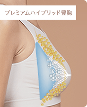 プレミアムハイブリッド豊胸