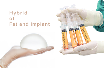 シリコンバッグ+脂肪注入 イメージ