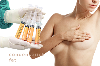 脂肪注入豊胸 イメージ