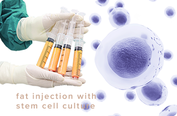 脂肪注入+培養幹細胞 イメージ