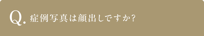 Q 症例写真は顔出しですか？